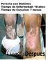Ulcera
