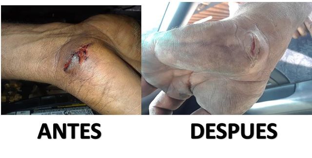 Mano cortada de un Mecanico.
10 dias de Aplicación de la Cera QR